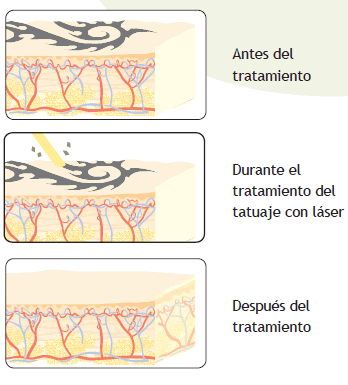 operativa tratamiento